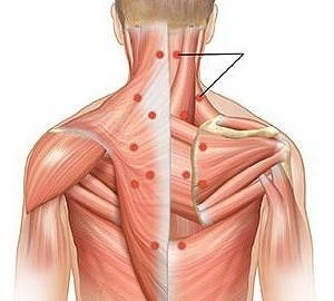 μυοσίτιδα ως αιτία πόνου στην πλάτη